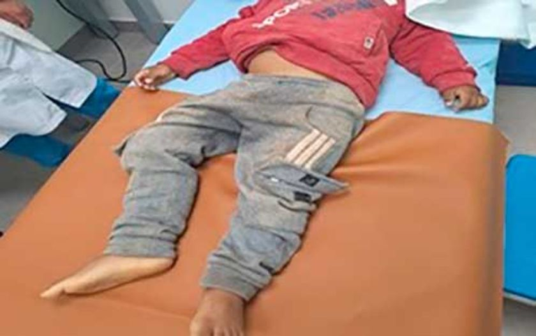 NIÑO MUERE TRAS CAER DE UN VEHÍCULO EN MOVIMIENTO NIÑO MUERE TRAS CAER DE UN VEHÍCULO EN MOVIMIENTO
