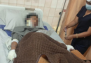 ADOLESCENTE QUEDA CON EL 25% DEL CUERPO QUEMADO TRAS PRESUNTO ATAQUE DE SU PAREJA EN COCHABAMBA