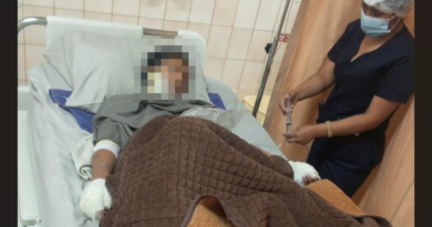 ADOLESCENTE QUEDA CON EL 25% DEL CUERPO QUEMADO TRAS PRESUNTO ATAQUE DE SU PAREJA EN COCHABAMBA