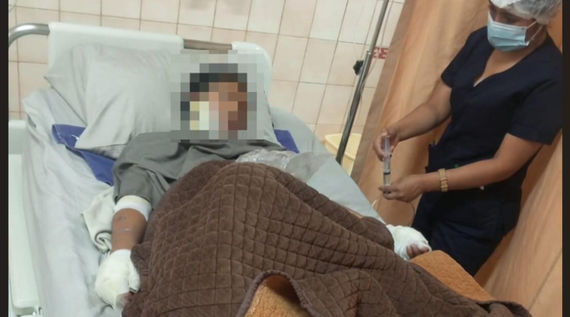 ADOLESCENTE QUEDA CON EL 25% DEL CUERPO QUEMADO TRAS PRESUNTO ATAQUE DE SU PAREJA EN COCHABAMBA